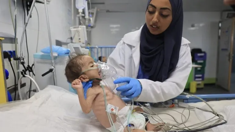 وزارة الصحة: 158 ألف حالة سوء تغذية حاد بين أطفال غزة حتى آب 2026