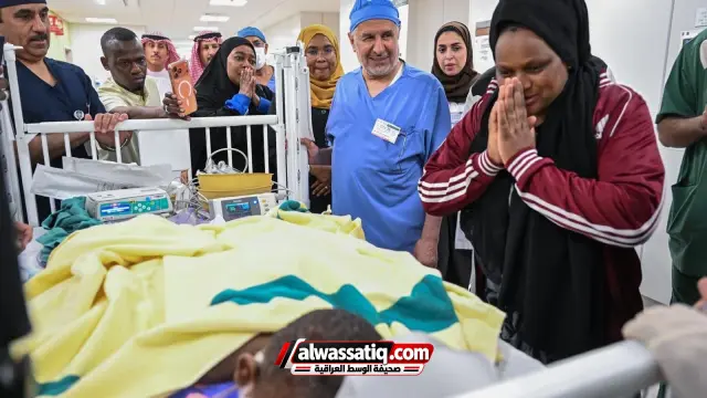 فريق سعودي ينجح في فصل التوأم التنزاني الملتصق لايتيينس ولوفنس بعد 14 ساعة ونصف